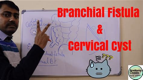 Embryological Basis Of Cervical Cyst Sinus And Branchial Fistula Youtube