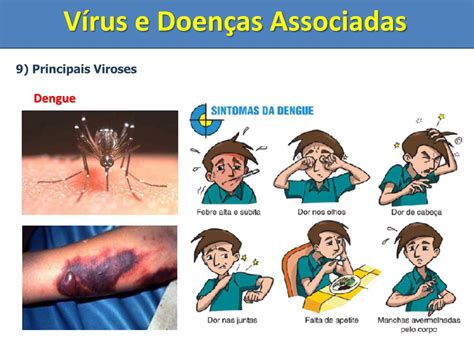 Doencas Causadas Por Virus - Quais Sao As Doencas Causadas Por Virus - FDPLEARN