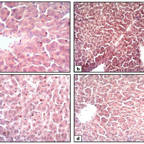 Photomicrographs Of H E Stained Rat Liver Sections The Control Rat