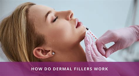 How Do Dermal Fillers Work Richardson S Plastic Surgery Hospitals