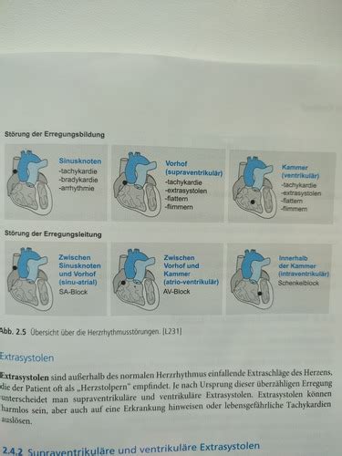 Kardio Angio Neu Karteikarten Quizlet