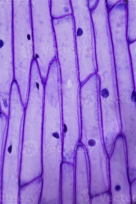 C Scara De Cebolla Morada Bajo El Microscopio Foto De Stock En