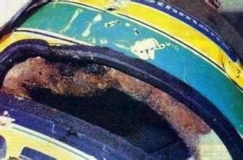 Ayrton Senna Resultado da Radiografia da Cabeça de Ayrton Senna