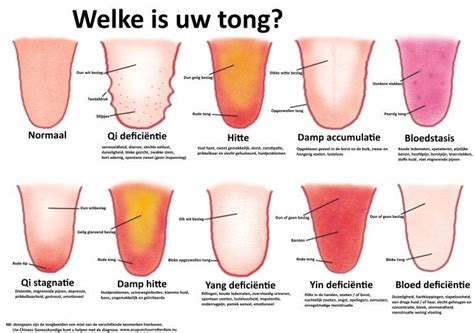 Tong Diagnose Acupunctuur En Gezondheidscentrum Chen