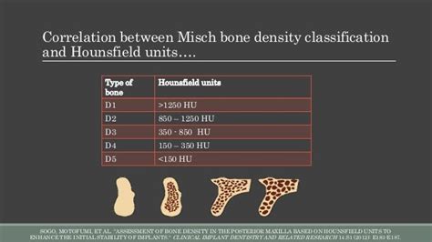 Bone Density Ppt