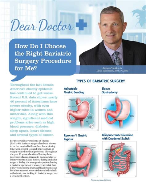 Dear Doctor How Do I Choose The Right Bariatric Surgery Procedure For