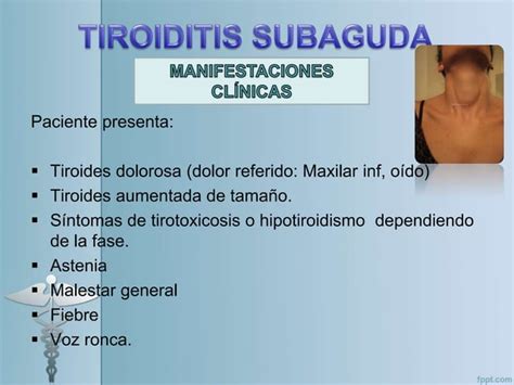 Tiroiditis Subaguda Huamanchumo Sandoval Samaria Ppt Descarga