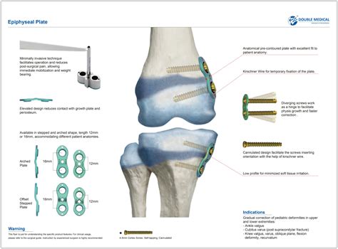 3.0/4.5mm Epiphyseal Plate,Medical Device Manufacturers -Double Medical