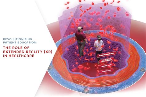 Revolutionizing Patient Education The Role Of Extended Reality XR In