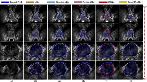 Figure From Domain Generalization For Prostate Segmentation In