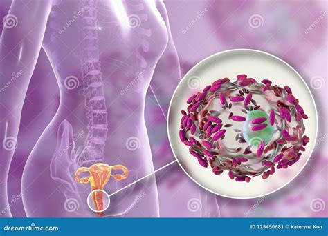 Bakterie Vaginosis Bakteriegardnerella Vaginalis Stock Illustrationer