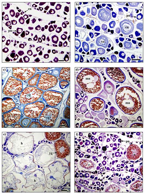 3 Histological Sections Showing Selected Stages In The Development Of