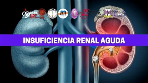 Insuficiencia Renal Aguda Youtube