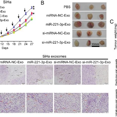 CSCC Exosomal MiR 221 3p Promotes Tumor Growth In Mouse Models A