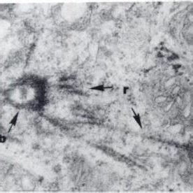 Low Power Electron Micrograph Of Statocyst From A Laboratory Reared