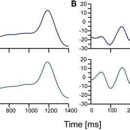 Typical brain waves observed during simultaneous measurement using the ...