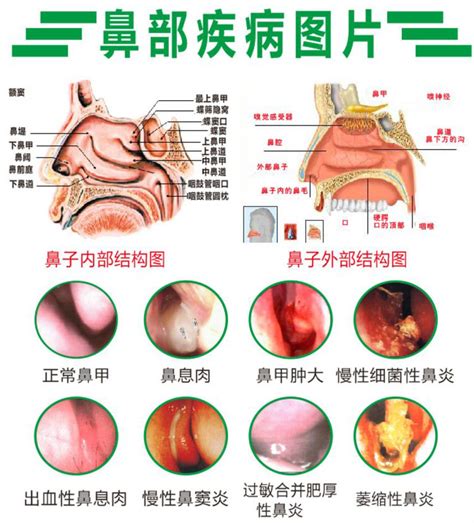 正知堂鼻炎特色门诊