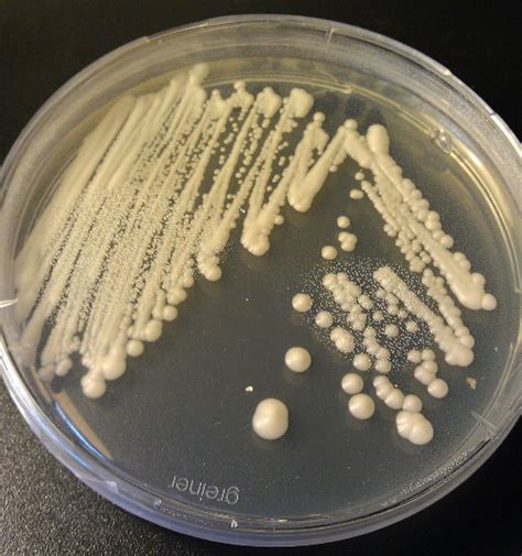 Morphologic Features Of Yeast Colonies Medical Laboratories