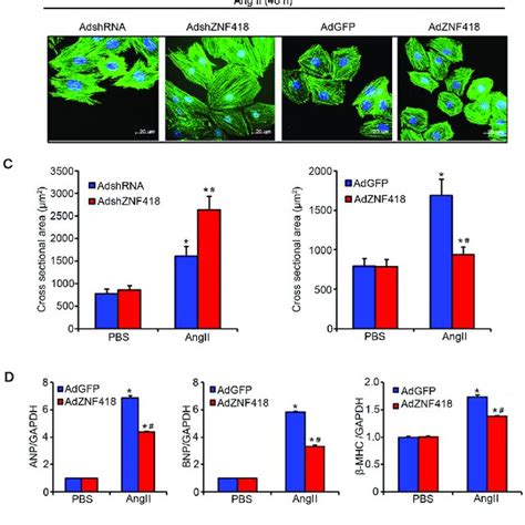 ZNF418 Overexpression Suppresses Angiotensin II Ang II Induced