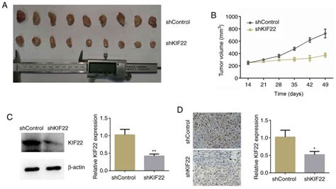 KIF22 Promotes Bladder Cancer Progression By Activating The Expression