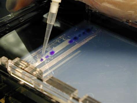 Gel Electrophoresis: Basics & Steps | SchoolWorkHelper