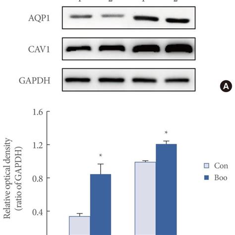 A Immunofluorescence Labeling Of Aquaporin 1 AQP1 And Caveolin 1