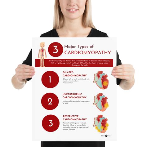 3 Major Types of Cardiomyopathy Infographic Poster | Etsy