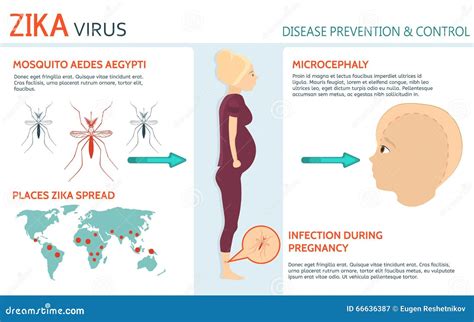 Zika Virus And Pregnancy Stock Vector Image