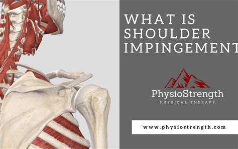 What is Shoulder Impingement - PhysioStrength