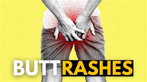 Butt Rashes What You Need To Know Youtube