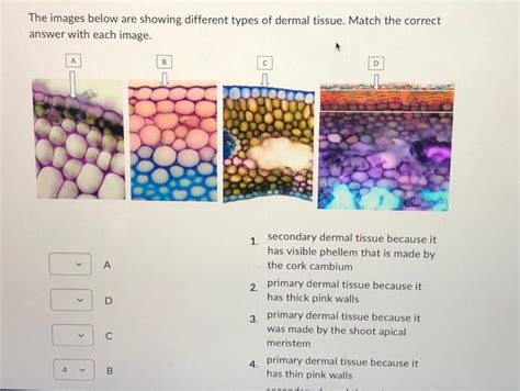 Solved The images below are showing different types of | Chegg.com