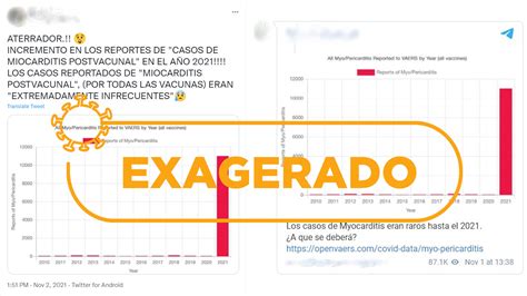 Miocarditis Por Vacuna Anticovid Una Reacción Muy Rara