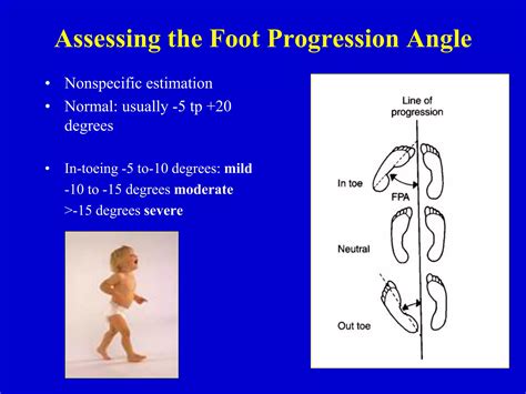 gait abnormalities in children.ppt