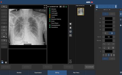 Deeply Integrated Ai To Detect Pathology At The Point Of Care Di Europe