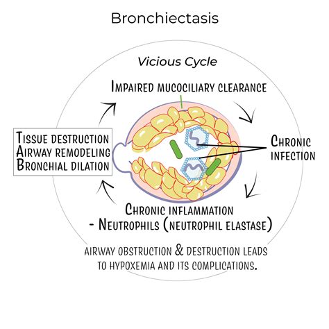 USMLE COMLEX Step 3 Glossary Bronchiectasis And Bronchiolitis For