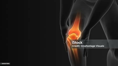 Knee Joint Pain Medical Concept Stock Photo - Download Image Now - Accidents and Disasters ...