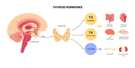 Hypothyroidism Illustrations Royalty Free Vector Graphics And Clip Art