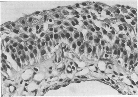 Stratified cuboidal epithelium composed of several layers of cuboidal ...