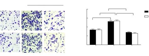 The Abilities Of Migration And Invasion Of Hypoxia Induced Nsclc Cells