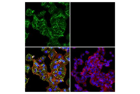 Cd44 156 3c11 Mouse Mab Cell Signaling Technology