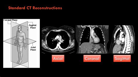 Radiology Quiz Radiopaedia Org Playlist Year