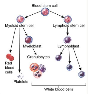 Childhood Leukemia sign and symptoms