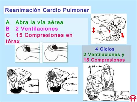 Curso Gratis De Primeros Auxilios Y Reanimación Cardiopulmonar Curso De Primeros Auxilios