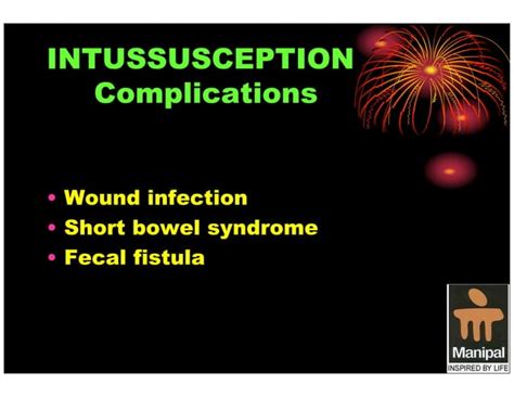 Pediatric Intussusception An Overview Ppt