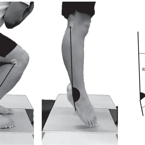 Video Analysis Of Maximum Dorsiflexion Angle A Plantarflexion At