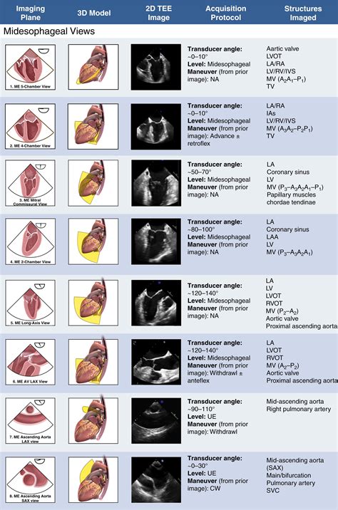 Transesophageal Echocardiography Tomographic Views Clinical Tree