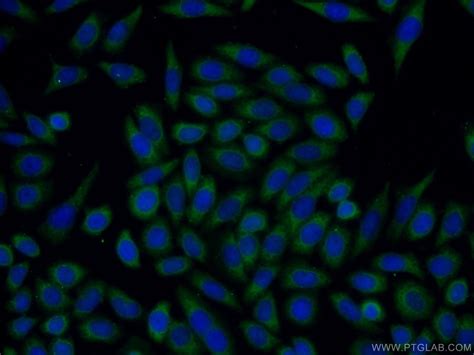 Tff2 Antibody 13681 1 Ap Proteintech