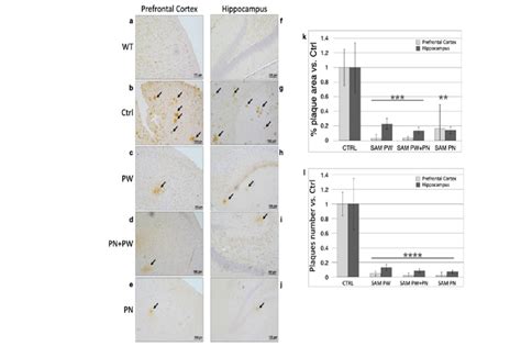 Amyloid Plaque Burden In Tgcrnd Mouse Brains At Months Of Age From