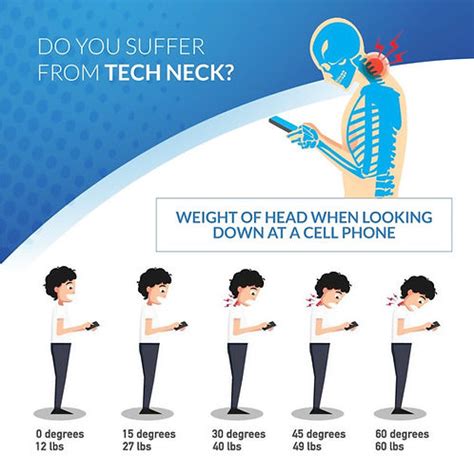 What is Tech-Neck? | TechRest Pillow