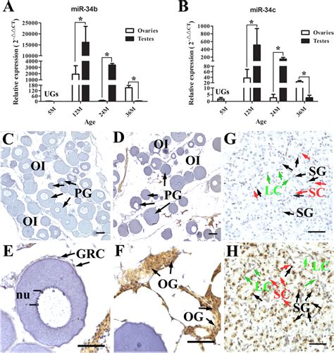 Mir 34bc Expression In Gonads During Sex Differentiation Of A